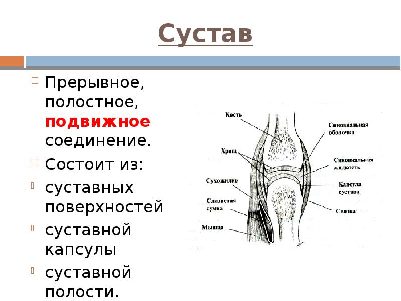 Сустав Прерывное, полостное, подвижное соединение. Состоит из: суставных поверхностей суставной капсулы