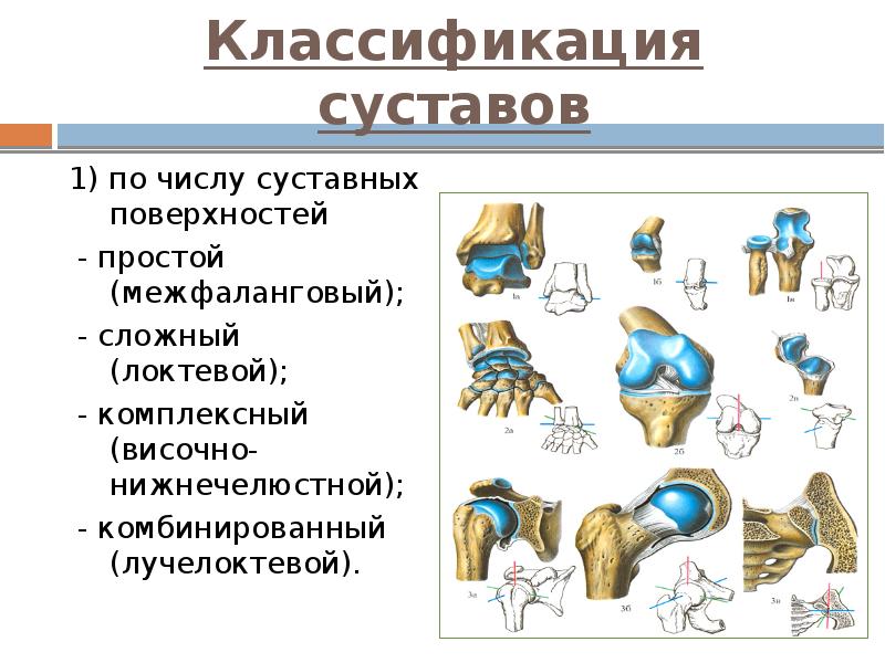 Классификация суставов 1) по числу суставных поверхностей  - простой (межфаланговый);