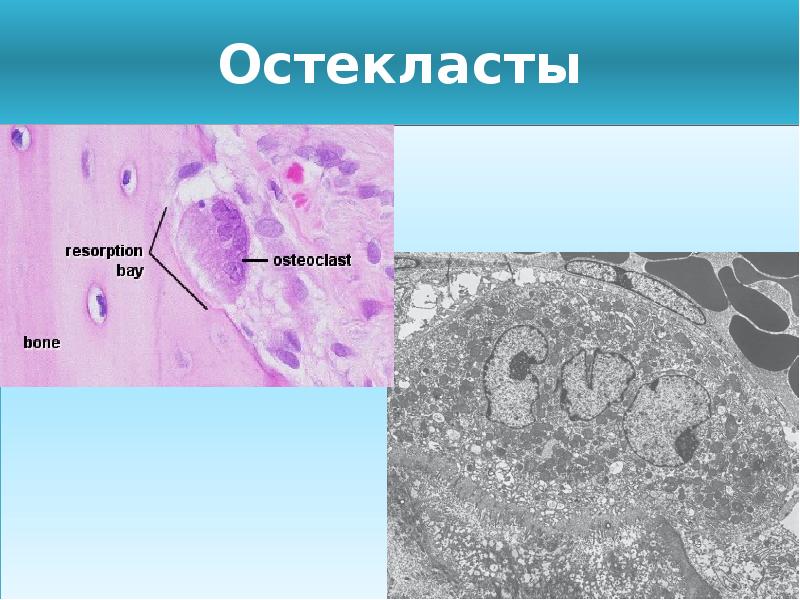 Непрямой остеогенез схема