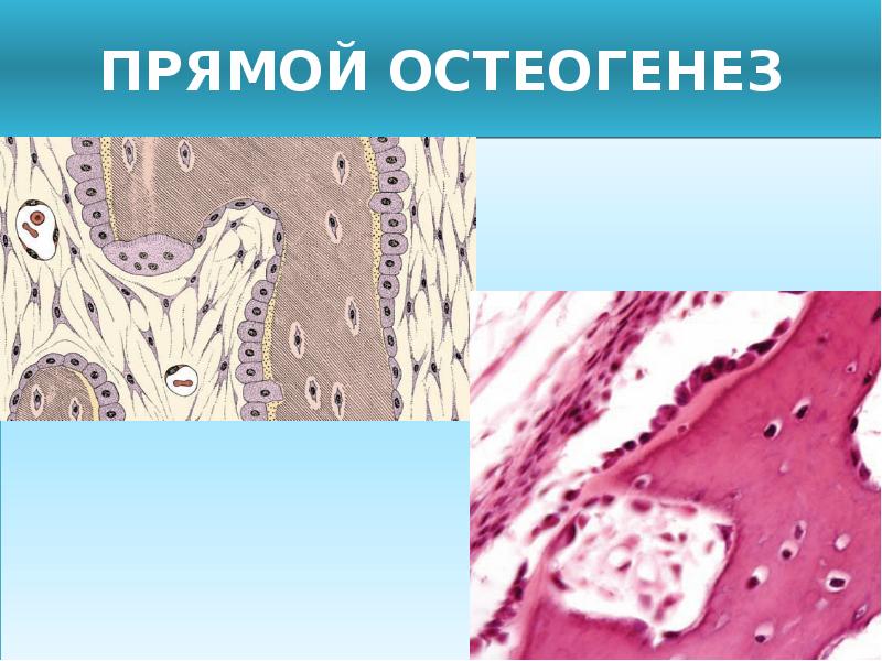 Непрямой остеогенез. Непрямой остеогенез костной ткани. Остеогенез гистология препарат. Костная ткань прямой остеогенез. Прямой и непрямой остеогенез.