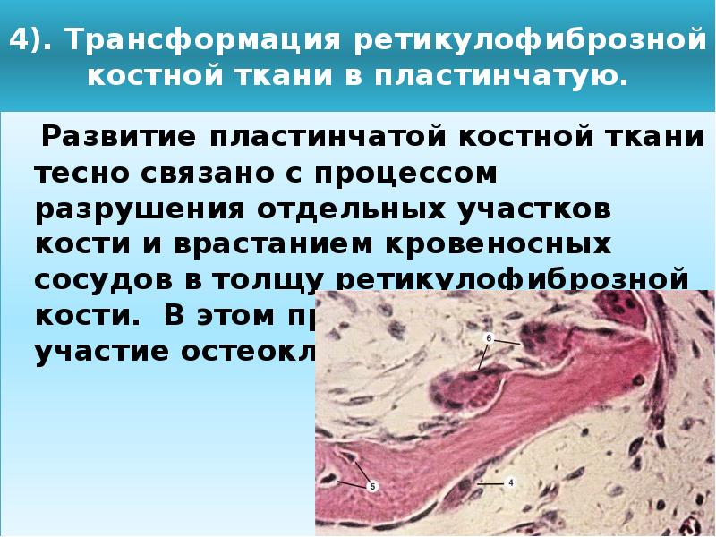 Схема непрямого остеогенеза гистология