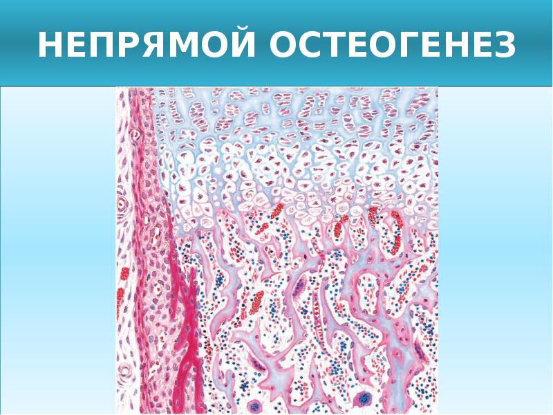 Трубчатая ткань. Остеогистогенез гистология. Непрямой остеогенез костной ткани. Прямой и непрямой остеогистогенез. Прямой остеогистогенез препарат гистология.