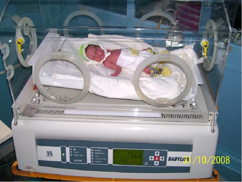 Патологии новорожденных и недоношенных детей фото
