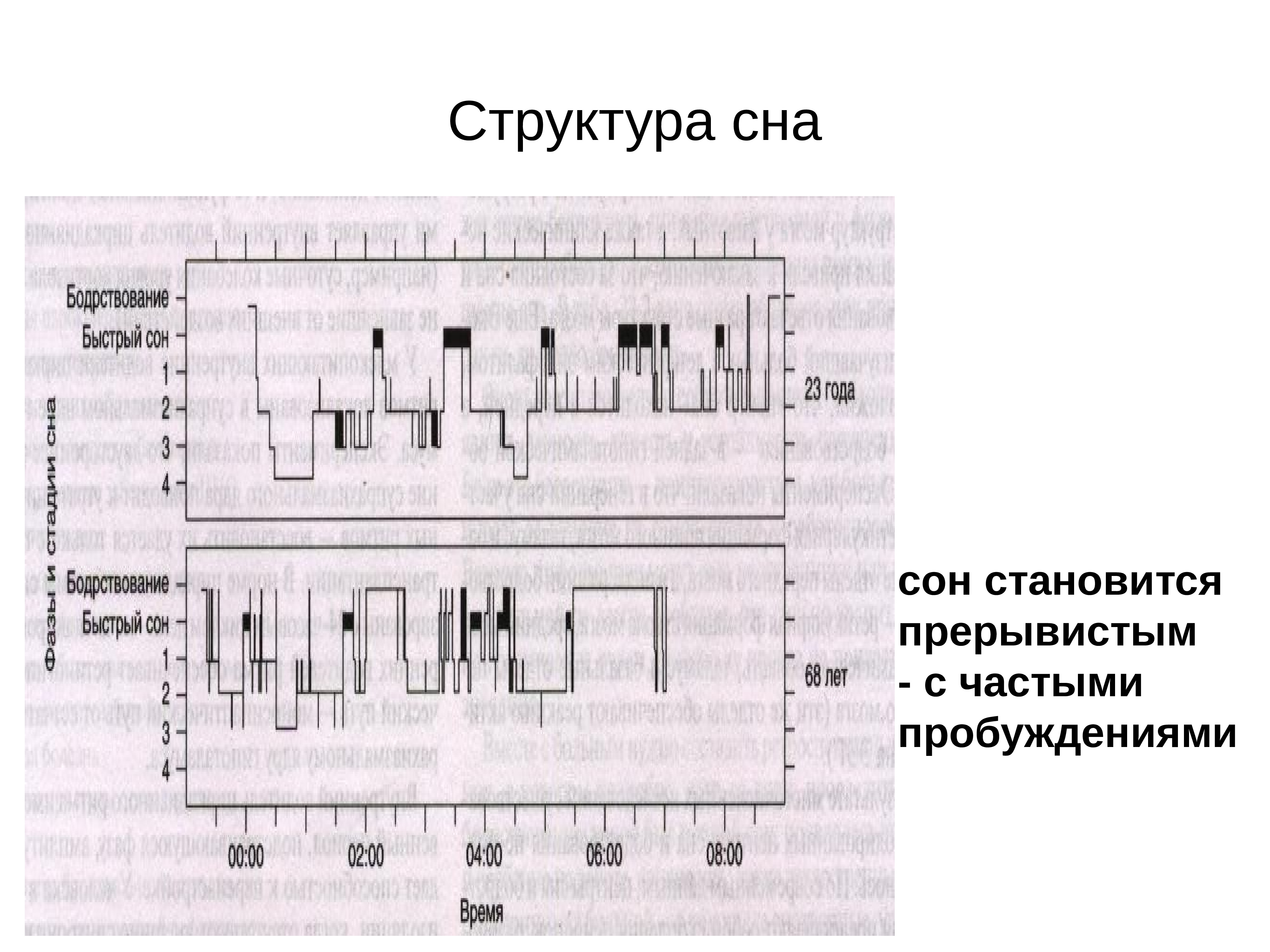 Морфологическое строение. Структура сна.