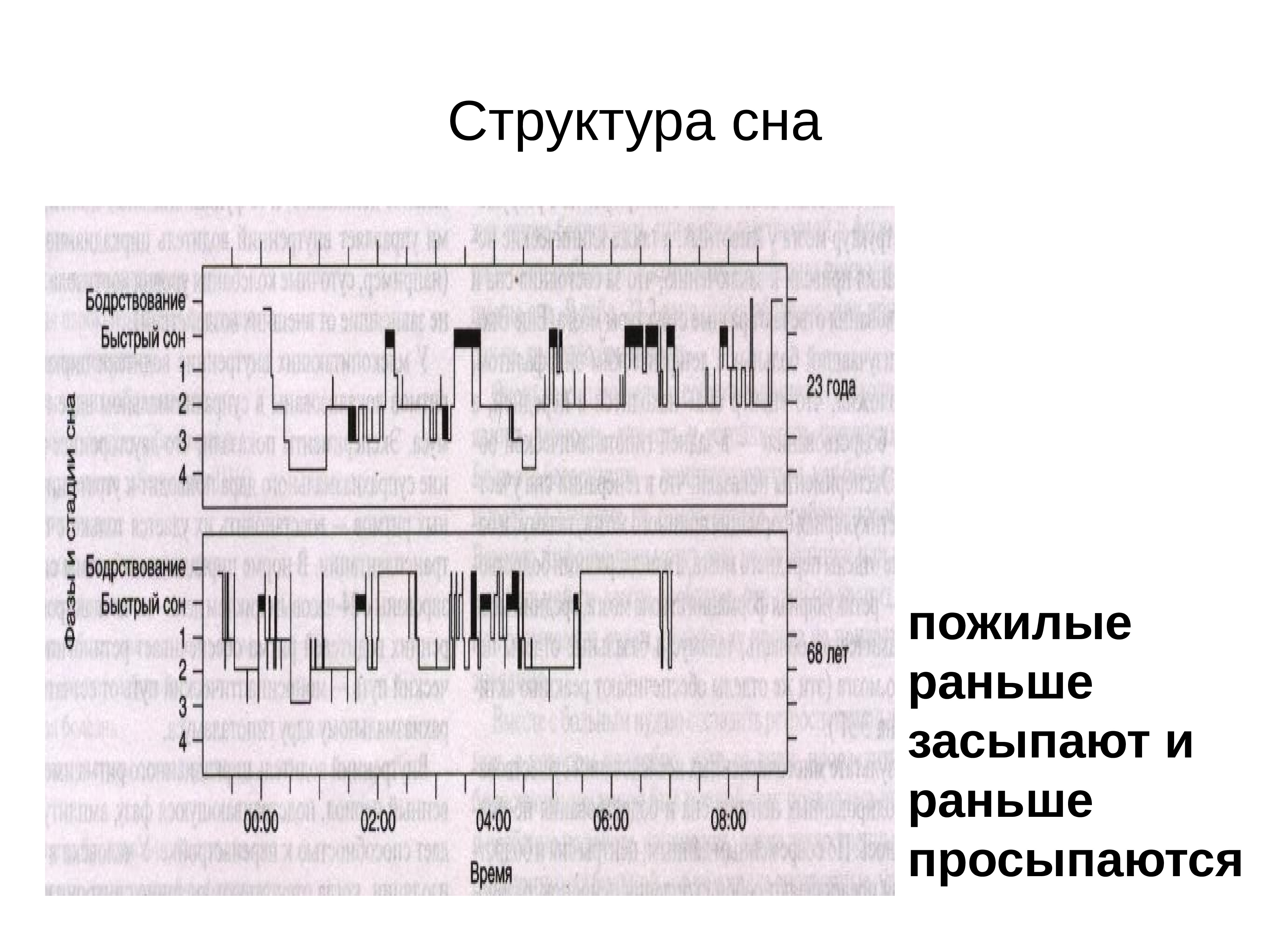 Структура спи. N структура сна. Иерархия снов. Анатомо морфологическое строение 46 и 36.