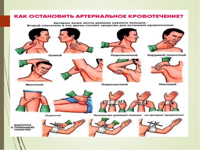 Кровотечения и первая помощь презентация