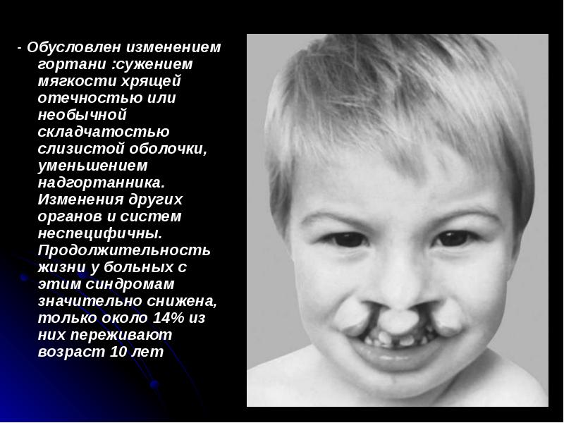 - Обусловлен изменением гортани :сужением мягкости хрящей отечностью или необычной складчатостью - Обусловлен изменением гортани :сужением мягкости хрящей отечностью или необычной складчатостью