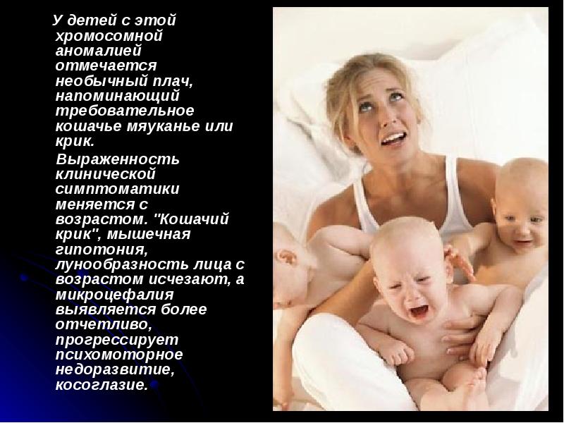 У детей с этой хромосомной аномалией отмечается необычный плач, напоминающий требовательное У детей с этой хромосомной аномалией отмечается необычный плач, напоминающий требовательное