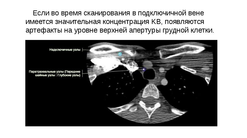 Артефакты кт изображений