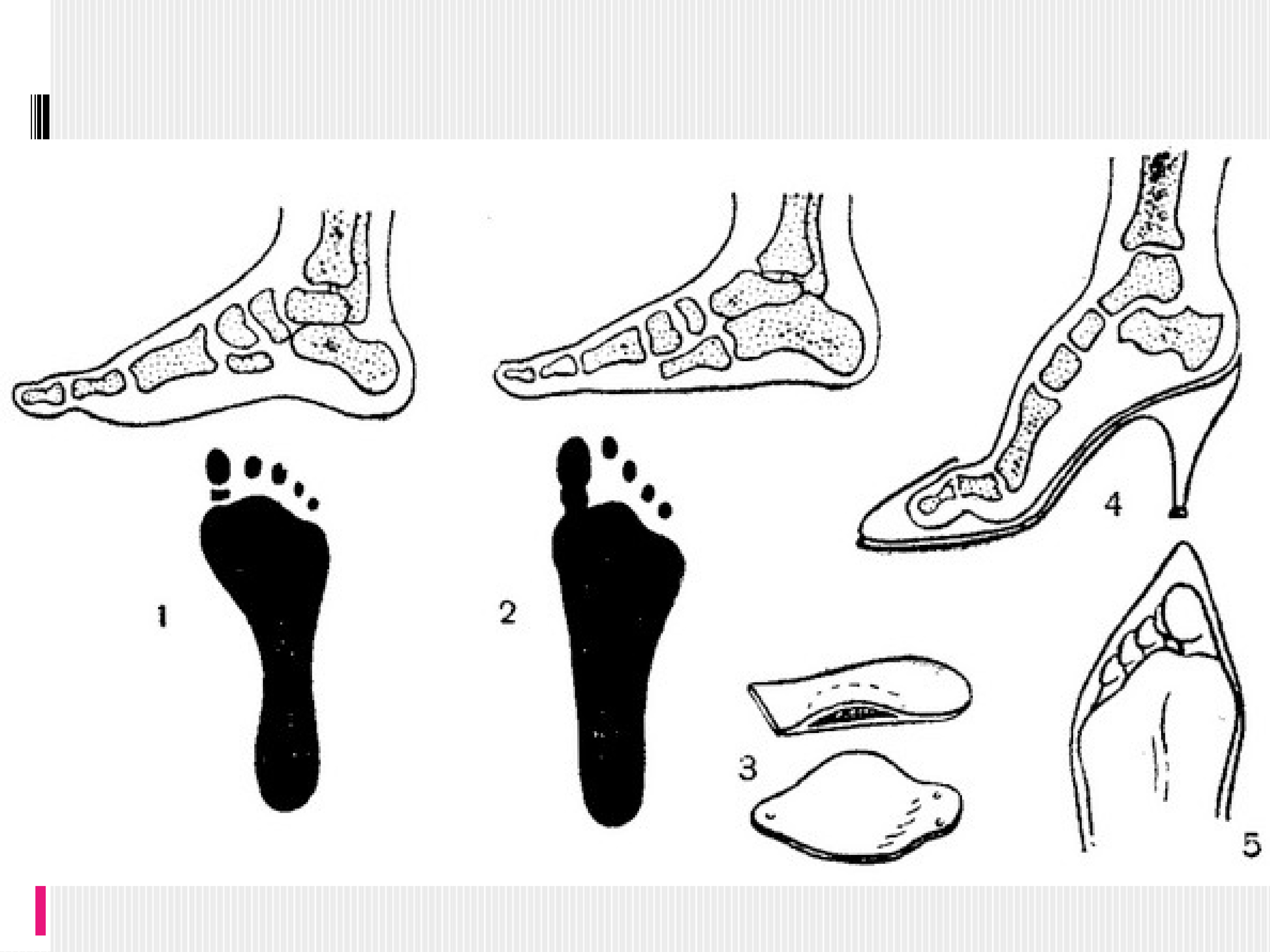 Гигиена обуви биология 8 класс. Гигиена обуви. Гигиена обуви рисунок. Гигиена обуви проект. Гигиена сапог.