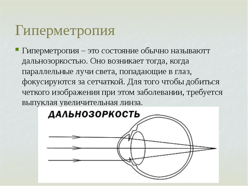 Гиперметропия что это такое. Декомпенсированная гиперметропия. Клинические проявления гиперметропии. Гиперметропия 3 степени. При дальнозоркости изображение фокусируется за сетчаткой.