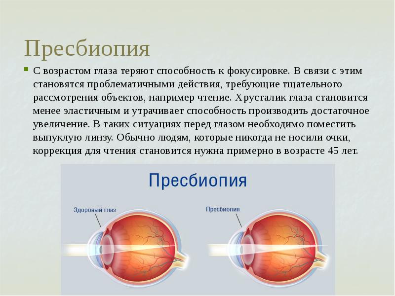 Глаз человека как оптическая система презентация