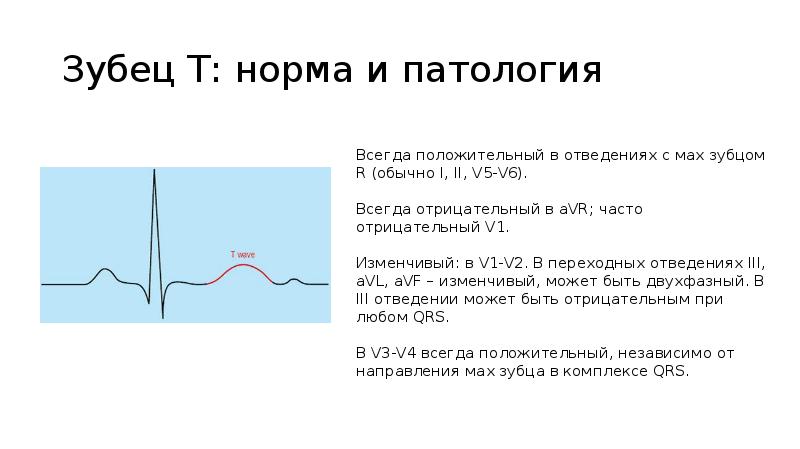 Зубец т. Патология зубца т. Патология зубца р. Зубец т норма и патология. Патологический зубец r в AVR.