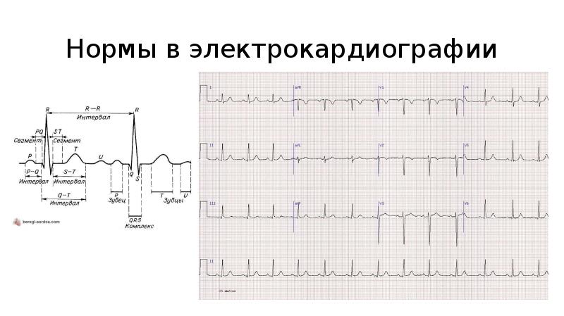 Функциональные методы исследования в кардиологии презентация