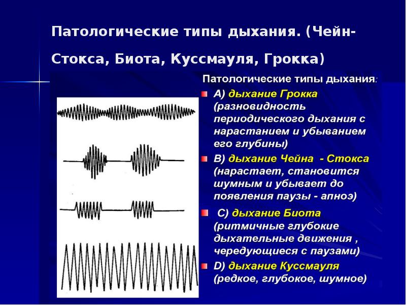 Типы дыхания картинка