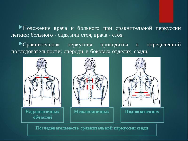 Перкуссия сердца в картинках