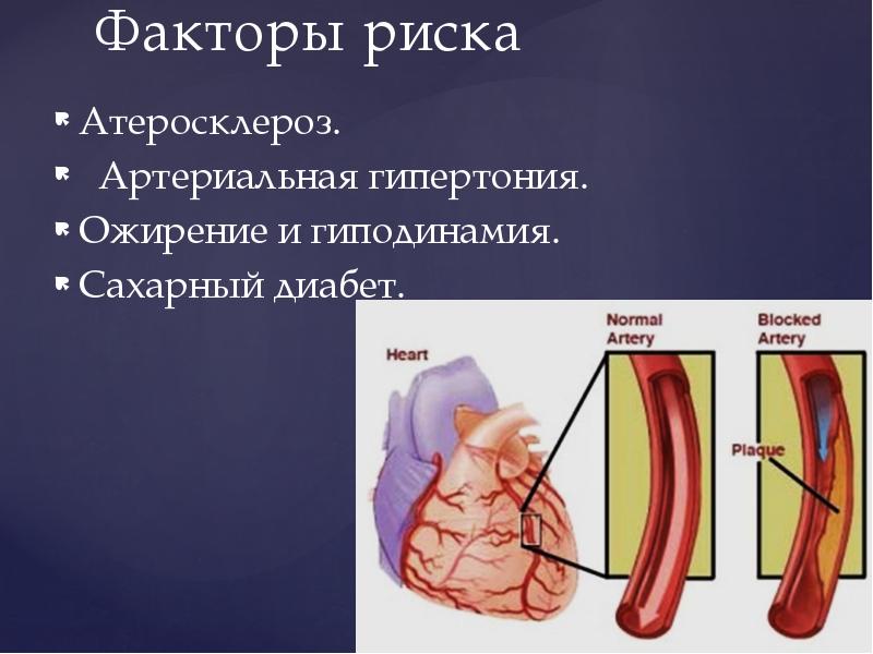 Презентация ишемия и инфаркт миокарда