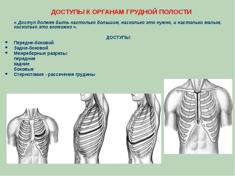 Операции на грудной стенке