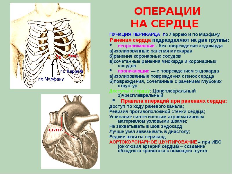 Топографическая анатомия сердца презентация