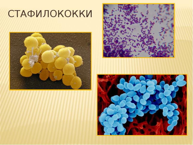 Staphylococcus aureus 5. Непатогенные стафилококки. Гноеродные бактерии (стафилококки). Кокки (бактерии) стафилококки. Золотистый стафилококк анаэроб.