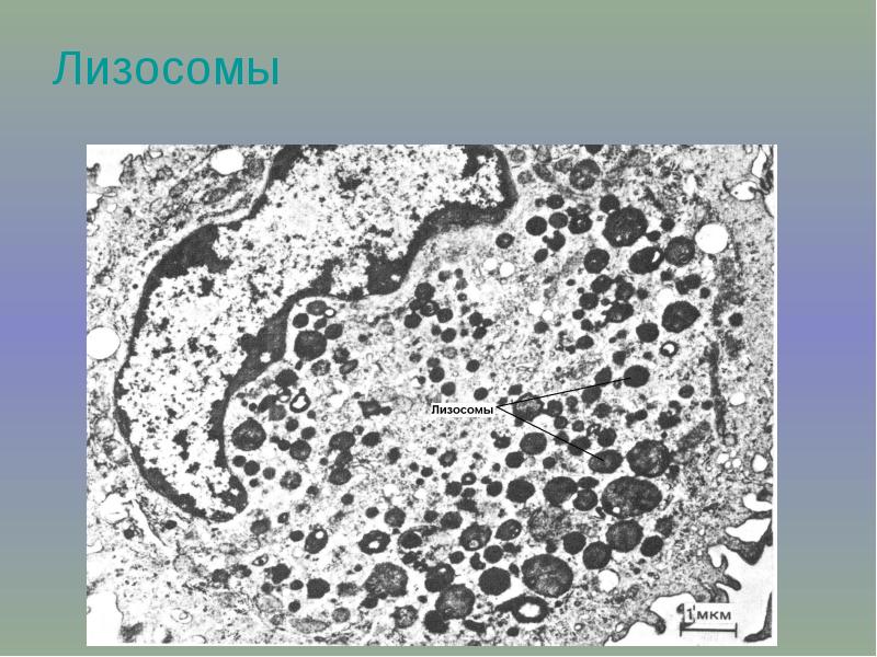 Лизосомы гистология. Электронограмма вторичной лизосомы. Лизосомы гистология. Лизосома электронная микрофотография. Макрофаг микрофотография гистология.
