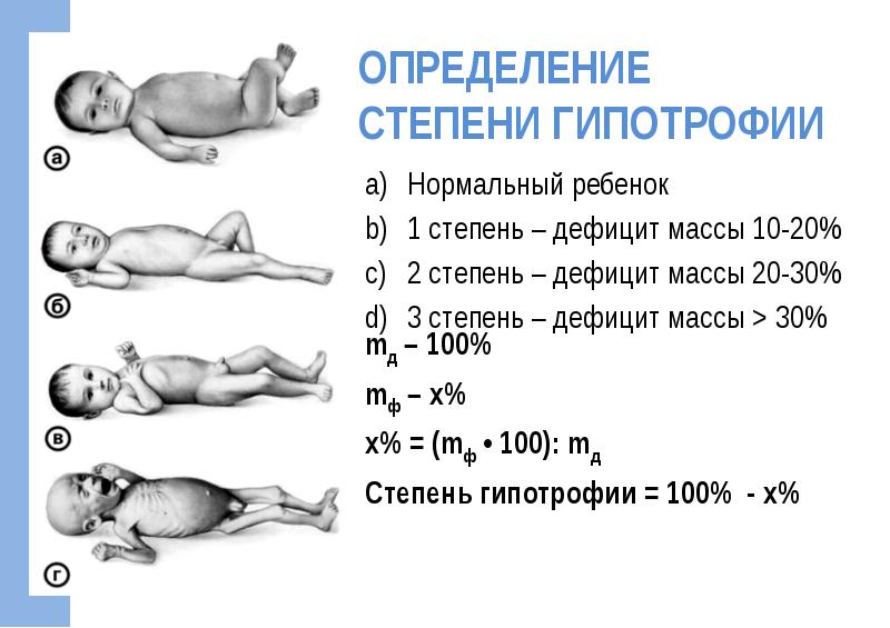 Методы расчета недостаточной массы тела у детей