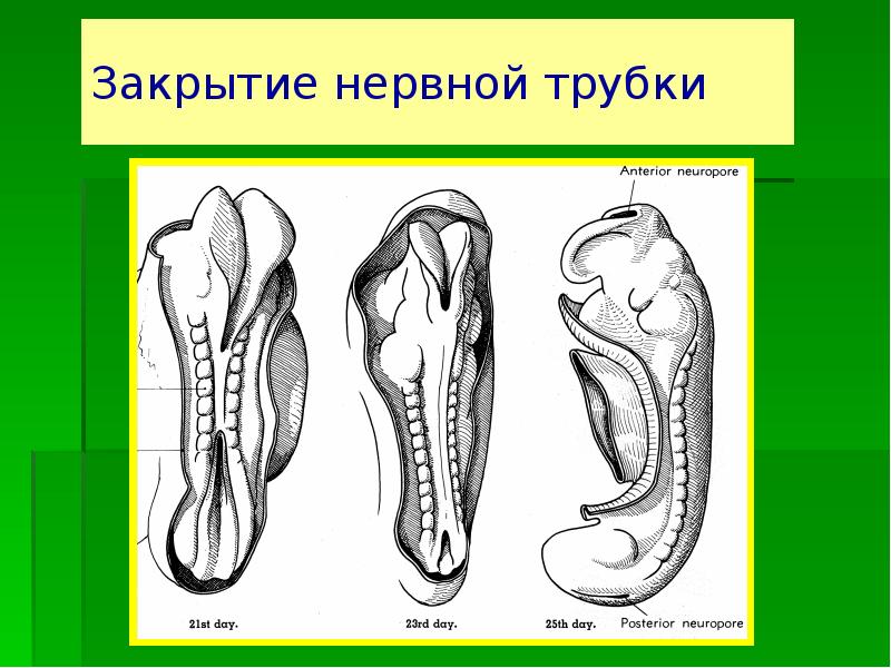 Стенка нервной трубки