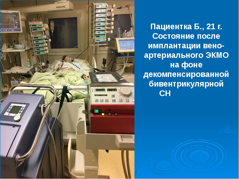 Что Такое Экмо Фото