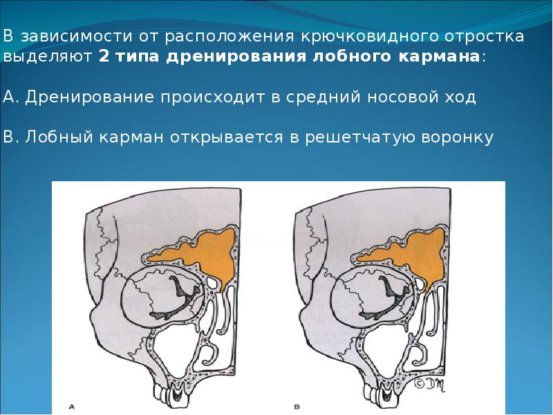 Анатомия носа и околоносовых пазух презентация