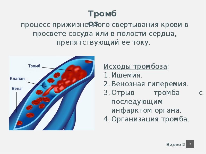 Признаки артериальной гиперемии рисунок