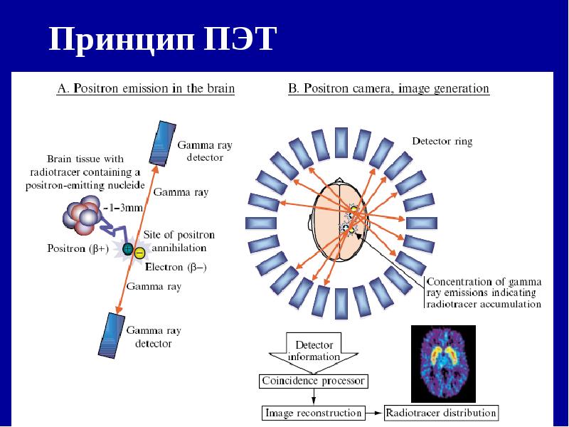 Пэт проект что это