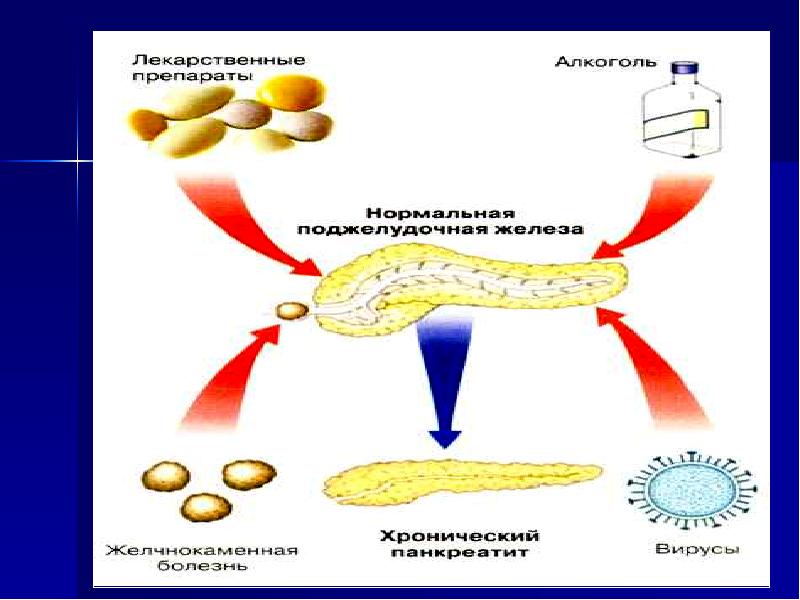 Хронический панкреатит картинки для презентации