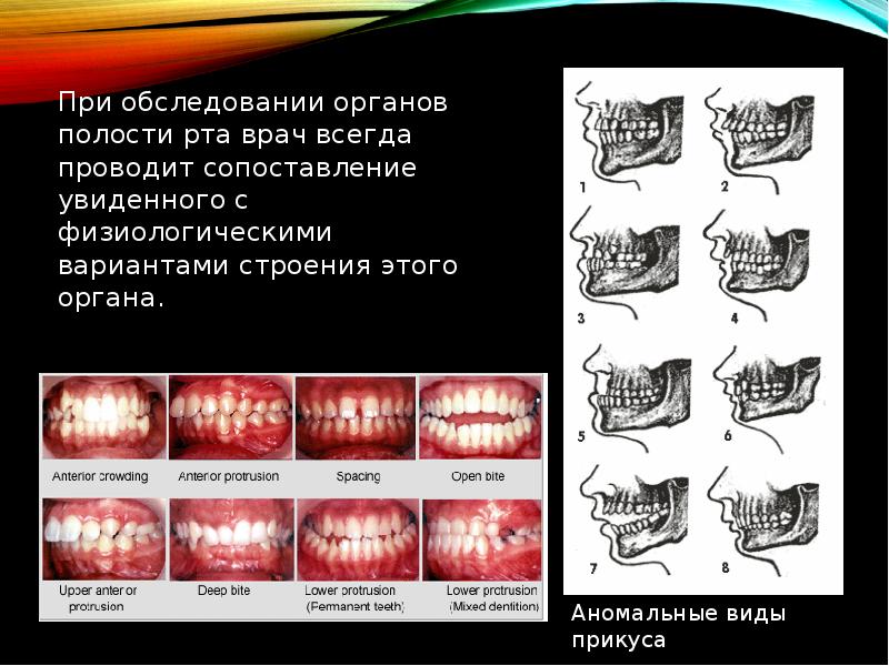 Клинический случай по ортопедической стоматологии презентация