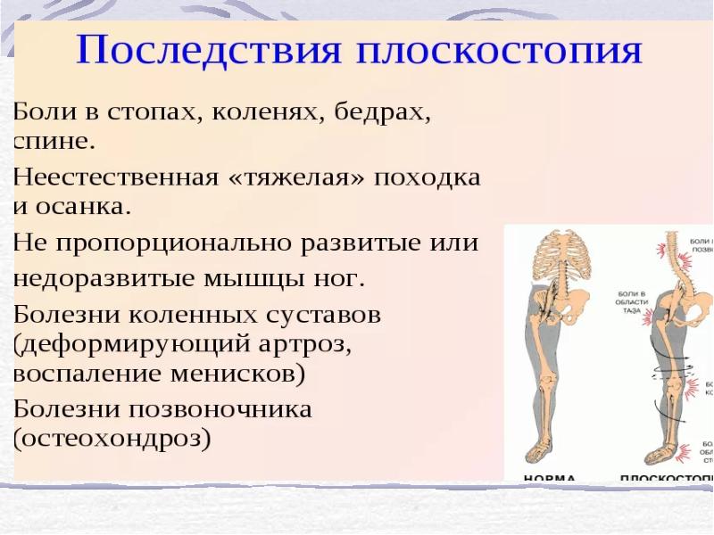 Коррекция осанки и телосложения презентация