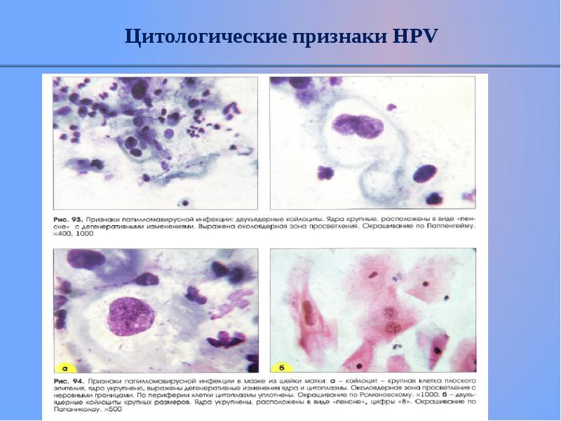 Цитологическая картина это