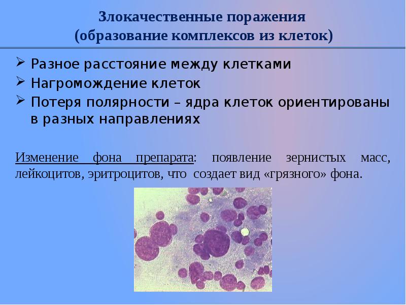 Клетки с гиперхромными ядрами. Полярность клеток. Злокачественные поражения клеток. Признаки злокачественности клетки. Цитологические критерии злокачественности.
