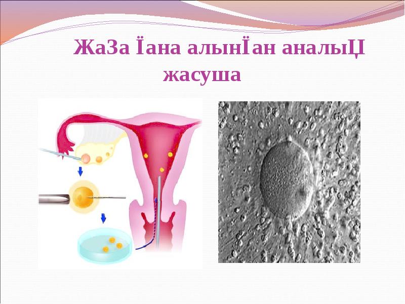 Жаңа ғана алынған аналық жасуша Жаңа ғана алынған аналық жасуша