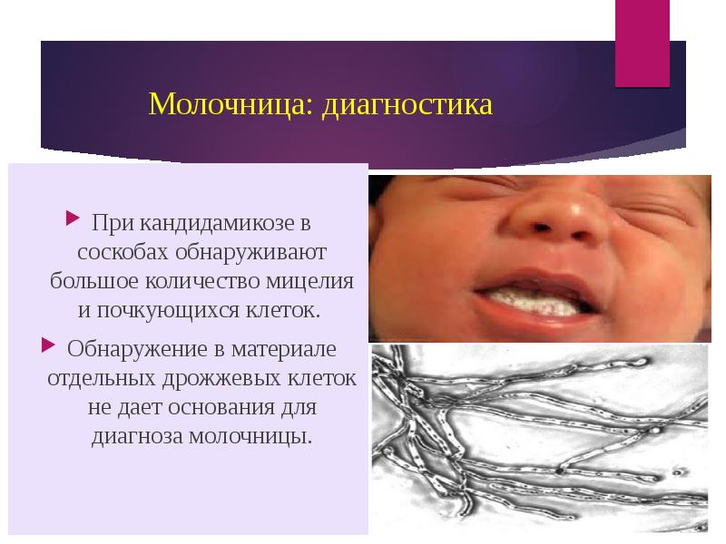 Kandida va uning inson salomatligi uchun xavfi Yomon kayfiyat yomon bo'lishi sha