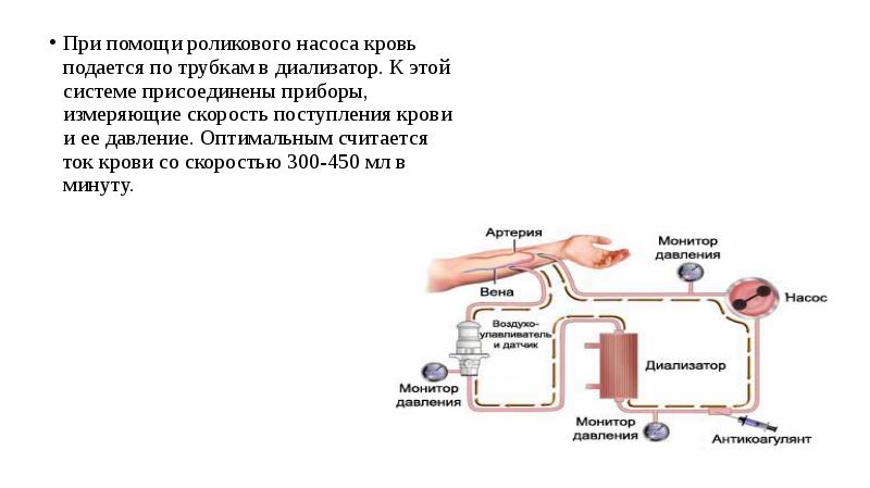 Перитонеальный диализ презентация