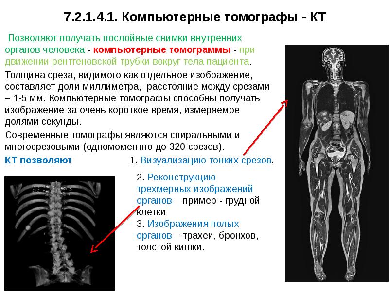 Серия компьютерных томограмм легких включая мультипланарную реконструкцию и 3 d изображение