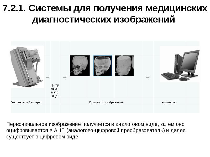 Методы получения и преобразования медицинских цифровых изображений их преимущества