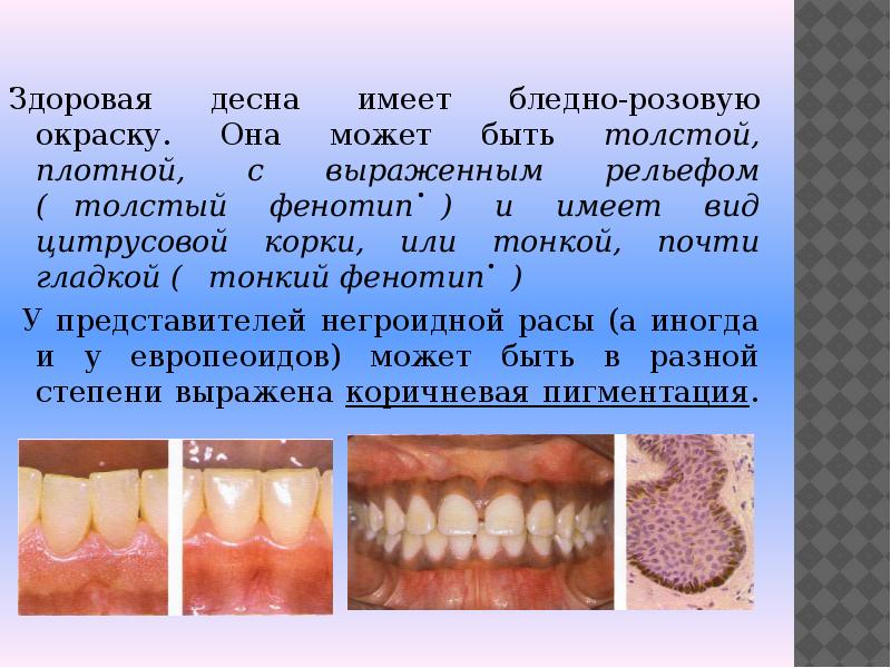 Анатомия пародонта презентация