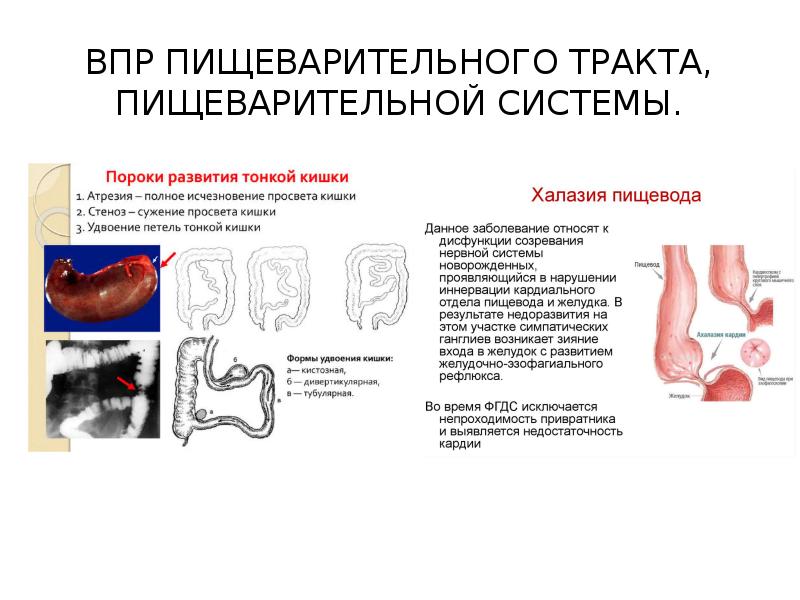 Презентация на тему нарушение сна