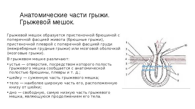 Вентральные грыжи презентация