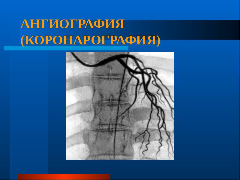 Презентация на тему атеросклероз сосудов