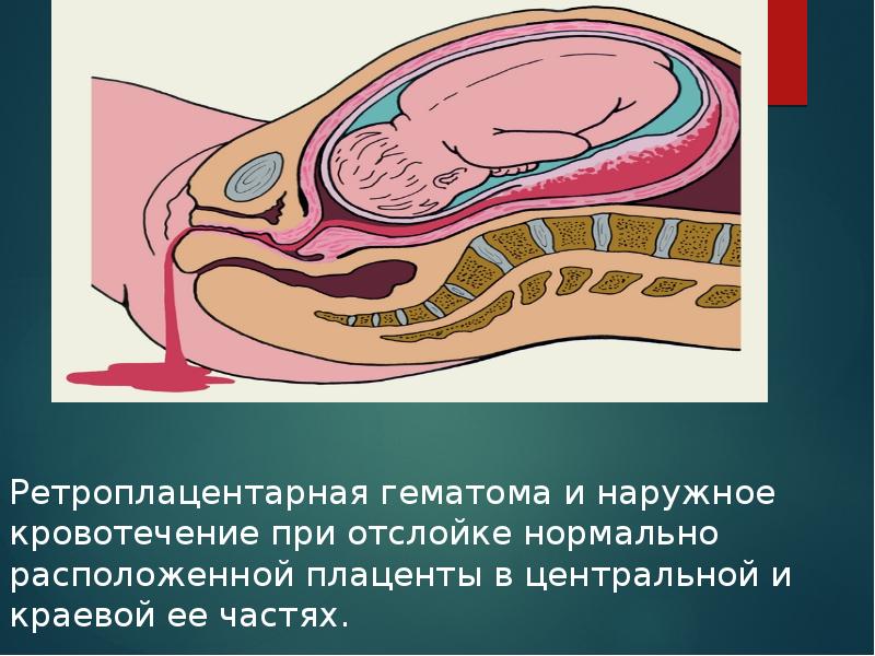 Влияние сексуальной жизни женщины на беременность