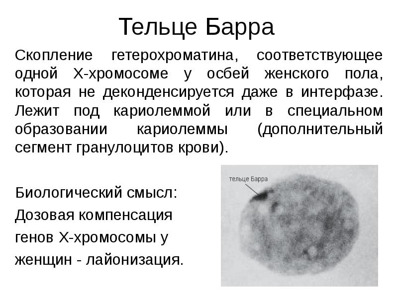 Тельца барра. Таблица половой хроматин тельце Барра. Тельца Барра это гетерохроматин. Тельца Барра в кариотипе. Тельца полового хроматина.