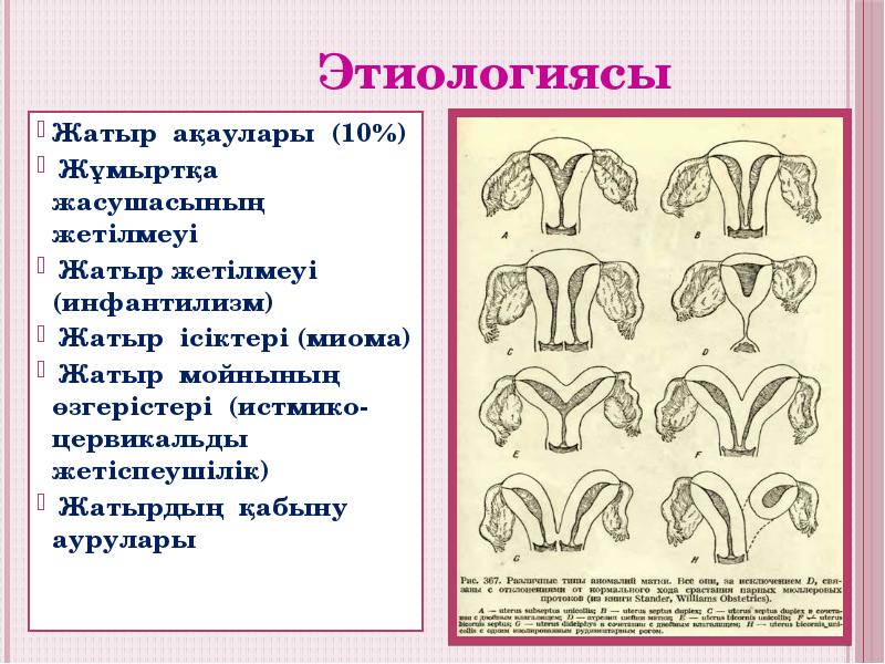 Жатыр ақаулары (10%)
Жұмыртқа жасушасының жетілмеуі
Жатыр жетілмеуі (инфантилизм)
Жатыр ақаулары (10%)
Жұмыртқа жасушасының жетілмеуі
Жатыр жетілмеуі (инфантилизм)