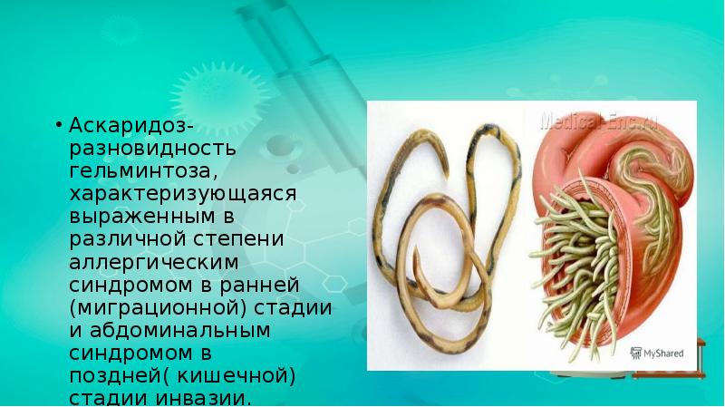Аскаридоз- разновидность гельминтоза, характеризующаяся выраженным в различной степени аллергическим синдромом в Аскаридоз- разновидность гельминтоза, характеризующаяся выраженным в различной степени аллергическим синдромом в