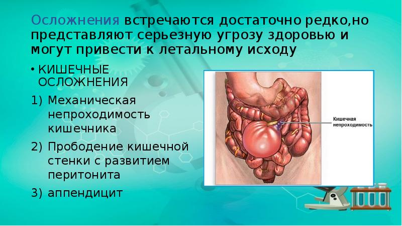 Осложнения встречаются достаточно редко,но представляют серьезную угрозу здоровью и могут привести Осложнения встречаются достаточно редко,но представляют серьезную угрозу здоровью и могут привести